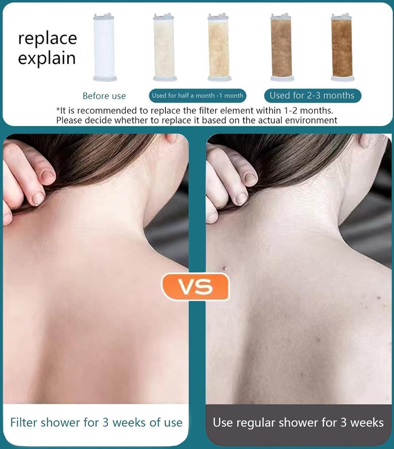 Douchekop met slang 1,5 m Hogedrukdouchekop Zwart met filter Antikalksproeiers Economy douchekop 6 modi Waterbesparende douchekop Douchekop Douche met douchefilter Gratis douche